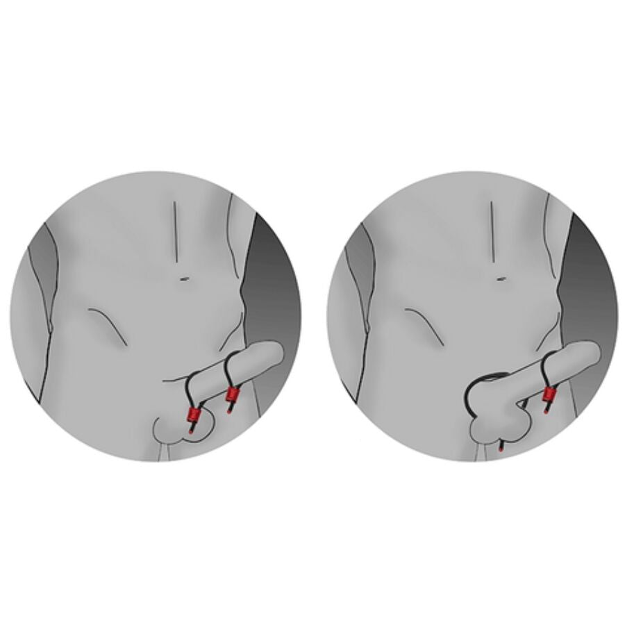 ELECTRASTIM - PRESTIGE ELECTRA LOOPS ANNEAUX PÉNIENS RÉGLABLES ROUGES